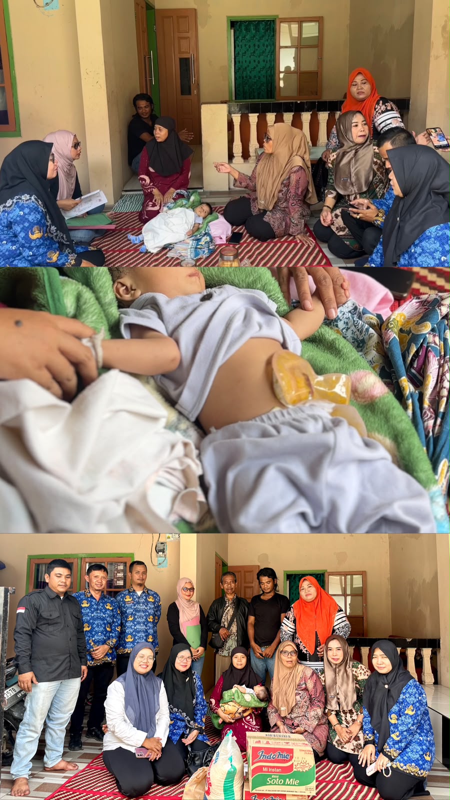 Dinas Sosial Kota Serang Respon Cepat Kasus Bayi Penyandang Atresia Ani, Salurkan Bantuan Permakanan
